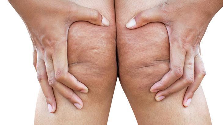 lipodem kadinlarin sessiz cigligi neden kilo veremiyorum diyenler icin cevap qTZyCLxM.jpg